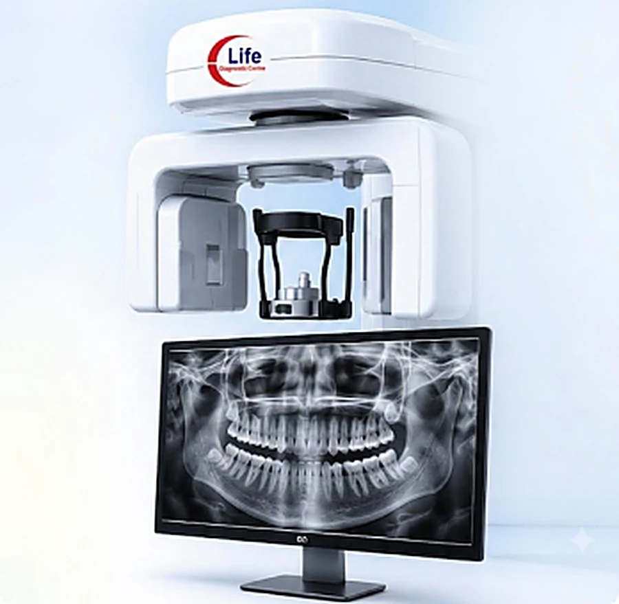Dental OPG