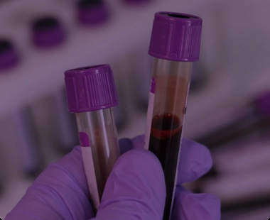 Complete Blood Count (CBC)