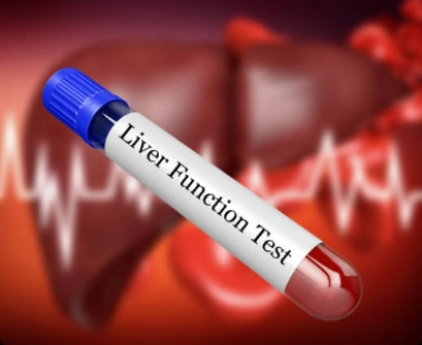 Liver Function Test (LFT)